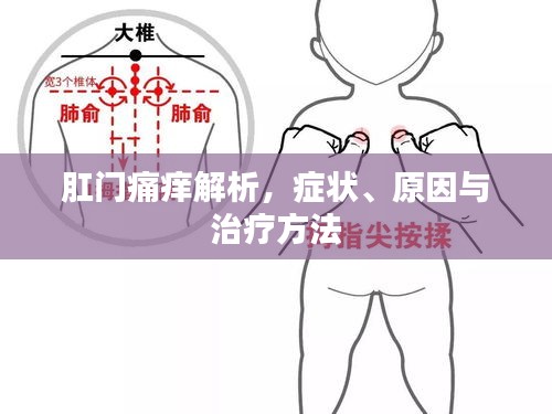 肛门痛痒解析，症状、原因与治疗方法